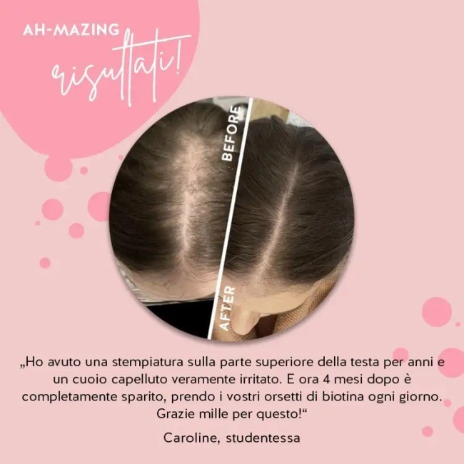 Bears With Benefits Ah-mazing Hair Vitamins Con Biotina 60 Caramelle Gommose Con Edulcoranti Senza Zuccheri