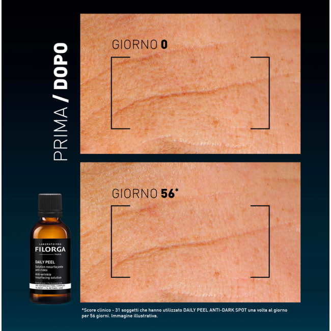 Filorga Daily Peel Wrinkles 50 Ml