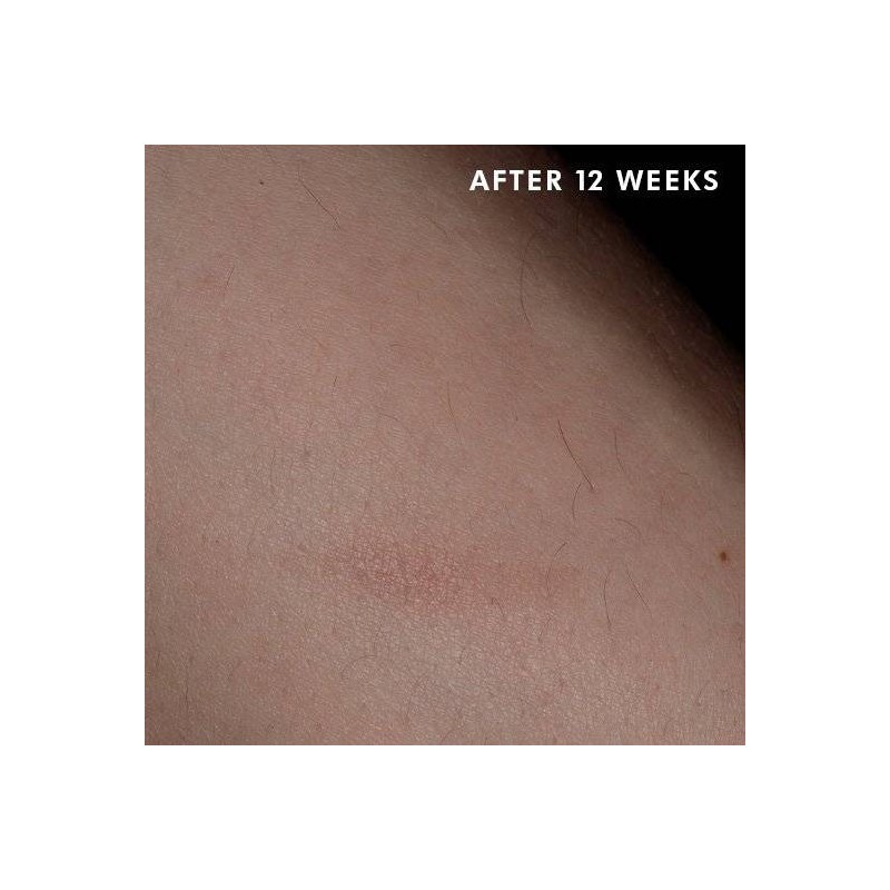 Skinceuticals Advanced Scar Control 50 Ml