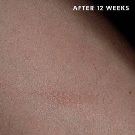 Skinceuticals Advanced Scar Control 50 Ml